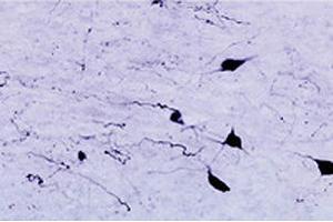 Immunohistochemical staining of HCRTR1 in rat zona incerta neurons using HCRTR1 polyclonal antibody , at a dilution of 1 : 1000. (HCRTR1 antibody  (AA 12-33))
