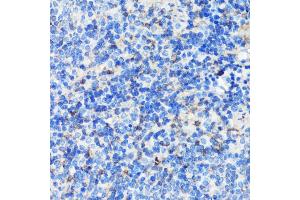 Immunohistochemistry of paraffin-embedded mouse spleen using Filamin A antibody (ABIN7267206) at dilution of 1:100 (40x lens). (Filamin A antibody  (C-Term))