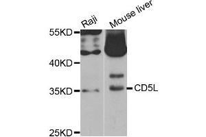Western Blotting (WB) image for anti-CD5 Molecule-Like (CD5L) antibody (ABIN1882350) (CD5L antibody)