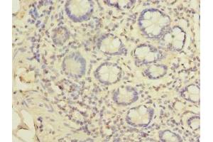 Immunohistochemistry of paraffin-embedded human small intestine tissue using ABIN7151342 at dilution of 1:100 (TSSC1 antibody  (AA 201-387))