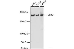 Western blot analysis of extracts of various cell lines using TCERG1 Polyclonal Antibody at dilution of 1:1000. (TCERG1 antibody)