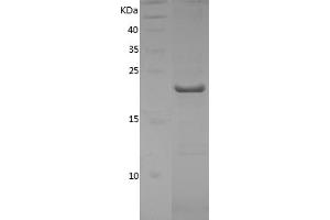 Western Blotting (WB) image for Cyclophilin B (PPIB) (AA 34-216) protein (His tag) (ABIN7122544)