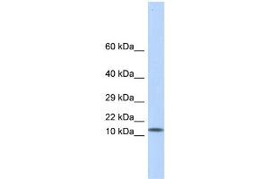 WB Suggested Anti-LGALS1 Antibody Titration: 0. (LGALS1/Galectin 1 antibody  (Middle Region))