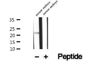 Western blot analysis of extracts of mouse embryo tissue, using UBE2E2 antibody. (UBE2E2 antibody  (N-Term))