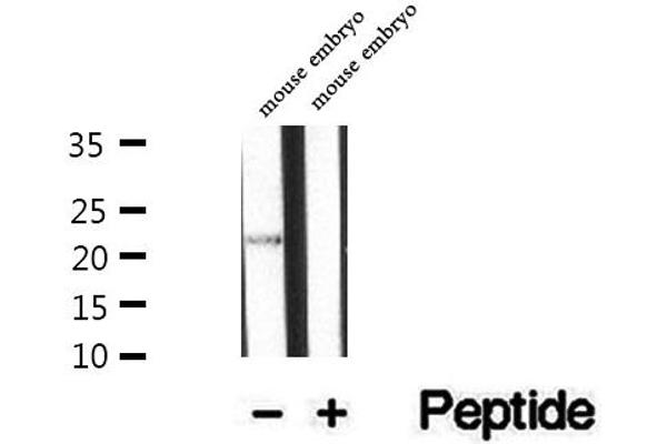 UBE2E2 antibody  (N-Term)