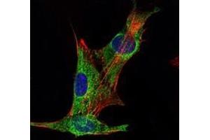 Immunofluorescence analysis of PANC-1 cells using INHA antibody (green). (Inhibin alpha antibody)