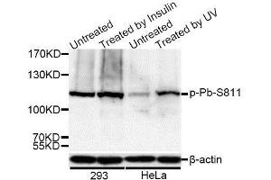 Western blot analysis of extracts of 293 and HeLa cells, using Phospho-Rb-S811 antibody (ABIN5969933) at 1/1000 dilution. (Retinoblastoma 1 antibody  (pSer811))
