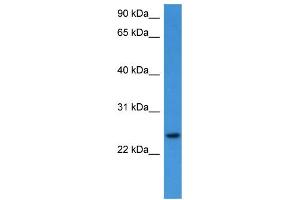 WB Suggested Anti-RHOG  Antibody Titration: 0. (RHOG antibody  (C-Term))