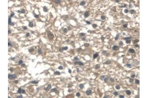 Immunohistochemistry (IHC) image for anti-Aldolase A, Fructose-Bisphosphate (ALDOA) (AA 18-273) antibody (ABIN7440131)