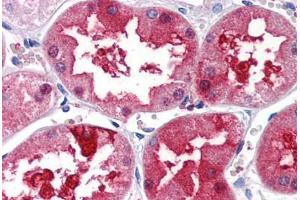 Human Kidney (formalin-fixed, paraffin-embedded) stained with PLXDC1 antibody ABIN351450 at 5 ug/ml followed by biotinylated goat anti-rabbit IgG secondary antibody ABIN481713, alkaline phosphatase-streptavidin and chromogen. (PLXDC1 antibody  (Internal Region))
