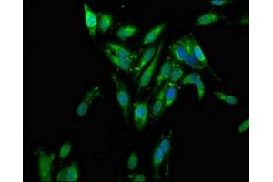 Immunofluorescence staining of Hela cells with ABIN7142604 at 1:100, counter-stained with DAPI. (AZI2 antibody  (AA 258-376))