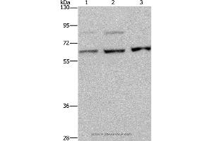 Western blot analysis of A431, MCF-7 and Hela cell, using KIF22 Polyclonal Antibody at dilution of 1:200 (KIF22 antibody)