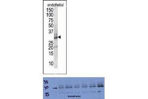 TOP: The anti-DSCR1 Pab is used in Western blot to detect DSCR1 in endothelial cell lysate. (RCAN1 antibody  (Middle Region))