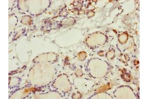 Immunohistochemistry of paraffin-embedded human thyroid tissue using ABIN7170586 at dilution of 1:100