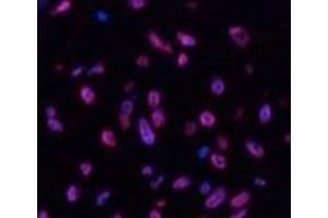Immunofluorescence analysis of Human uterus tissue using Desmin Monoclonal Antibody at dilution of 1:200. (Desmin antibody)