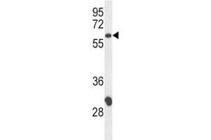 Western blot analysis of CD4 antibody and CEM lysate; Expected size: 40~60 kDa depending on glycosylation level (CD4 antibody  (AA 58-86))
