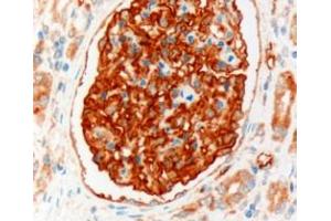 ABIN185496 (3µg/ml) staining of paraffin embedded Human Kidney. (SLC9A3R2 antibody  (Internal Region))