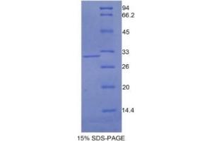 SDS-PAGE (SDS) image for Cadherin 2 (CDH2) ELISA Kit (ABIN6574280)