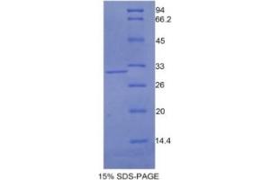 SDS-PAGE of Protein Standard from the Kit (Highly purified E. (N-Cadherin ELISA Kit)