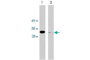 Western blot using FHL2 polyclonal antibody on HeLa cell extract (10 ug/lane). (FHL2 antibody)