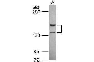 WB Image Sample (30 ug of whole cell lysate) A: Jurkat 5% SDS PAGE antibody diluted at 1:1000 (NMDAR2A antibody  (N-Term))