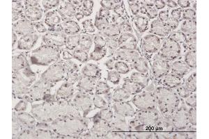 Immunoperoxidase of purified MaxPab antibody to RBM5 on formalin-fixed paraffin-embedded human stomach. (RBM5 antibody  (AA 1-546))