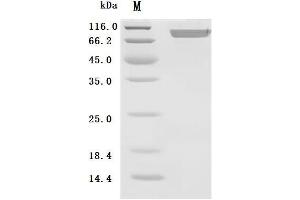 Fibroblast Activation Protein, alpha (FAP) (AA 26-761) (Active) protein (His tag)