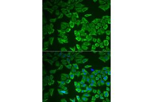 Immunofluorescence analysis of HeLa cell using CRHBP antibody. (CRHBP antibody)