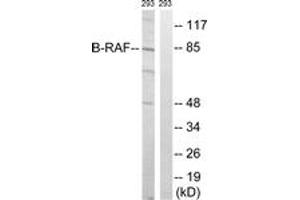 Western blot analysis of extracts from 293 cells, treated with insulin 0. (SNRPE antibody  (AA 411-460))