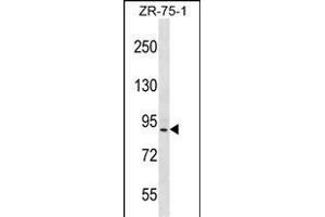 HRC Antibody (Center) (ABIN656657 and ABIN2845898) western blot analysis in ZR-75-1 cell line lysates (35 μg/lane).
