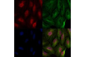 Histone H3 Antibody staining A549 cells by IF/ICC. (Histone 3 antibody)