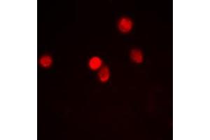 Immunofluorescent analysis of RACK7 staining in Hela cells. (ZMYND8 antibody  (Center))