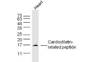 Mouse heart lysates probed with Cardiodilatin-related peptide Polyclonal Antibody, Unconjugated  at 1:300 dilution and 4˚C overnight incubation. (NPPA antibody  (AA 26-55))