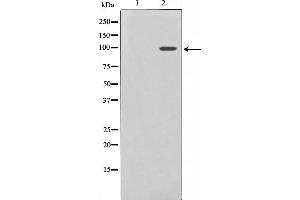Western blot analysis on HuvEc cell lysate using Nrf2 Antibody,The lane on the left is treated with the antigen-specific peptide. (NRF2 antibody  (N-Term))