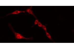 ABIN6274384 staining HeLa cells by IF/ICC. (PFKFB3 antibody)