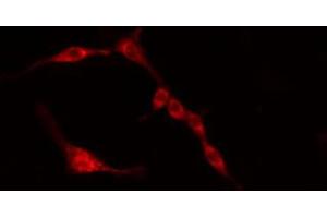 ABIN6274384 staining HeLa cells by IF/ICC. (PFKFB3 antibody)