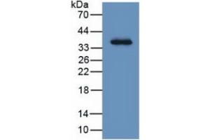 WB of Protein Standard: different control antibodies  against Highly purified E. (LRG1 ELISA Kit)