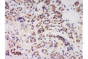 Formalin-fixed and paraffin embedded human kidney labeled with Anti-Caspase-6 (NT) Polyclonal Antibody, Unconjugated  at 1:500 followed by conjugation to the secondary antibody and DAB staining.