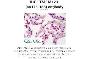 Image no. 1 for anti-Transmembrane Protein 123 (TMEM123) (AA 173-188) antibody (ABIN1740149)