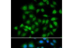 Immunofluorescence analysis of HeLa cells using MXI1 Polyclonal Antibody (MXI1 antibody)