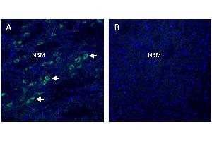 Stromal interaction molecule 2 (STIM2) in mouse nucleus basalis (NBM) regionA. (Stim2 antibody  (Intracellular))