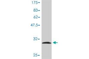Western Blot detection against Immunogen (31.