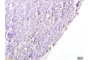Formalin-fixed and paraffin embedded mouse pancreas labeled with Anti-4 Hydroxynonenal Polyclonal Antibody, Unconjugated (ABIN873270) at 1:200 followed by conjugation to the secondary antibody and DAB staining. (HNE antibody)