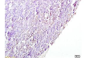 Formalin-fixed and paraffin embedded mouse pancreas labeled with Anti-4 Hydroxynonenal Polyclonal Antibody, Unconjugated (ABIN873270) at 1:200 followed by conjugation to the secondary antibody and DAB staining.