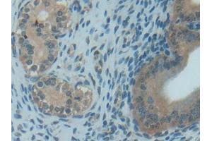 DAB staining on IHC-P; Samples: Rat Uterus Tissue (TXN antibody  (AA 1-105))