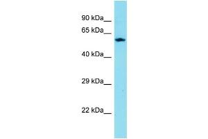 Host: Rabbit Target Name: CXXC11 Sample Type: ACHN Whole cell lysates Antibody Dilution: 1. (CXXC11 antibody  (C-Term))