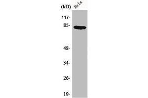 Western Blot analysis of HeLa cells using Catenin-γ Polyclonal Antibody (JUP antibody  (C-Term))