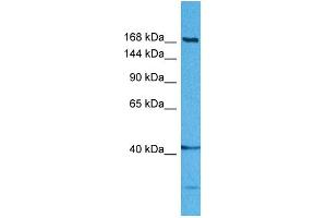 Host:  Rabbit  Target Name:  DISP1  Sample Tissue:  Human MDA-MB-435s Whole Cell  Antibody Dilution:  1ug/ml