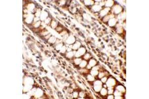 Immunohistochemistry of Periphilin in human colon tissue with Periphilin antibody at 2. (PPHLN1 antibody  (Middle Region))