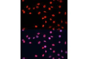 Immunofluorescence analysis of C6 cells using FUS antibody (ABIN6127938, ABIN6140818, ABIN6140819 and ABIN7101788) at dilution of 1:100. (FUS antibody  (AA 297-526))